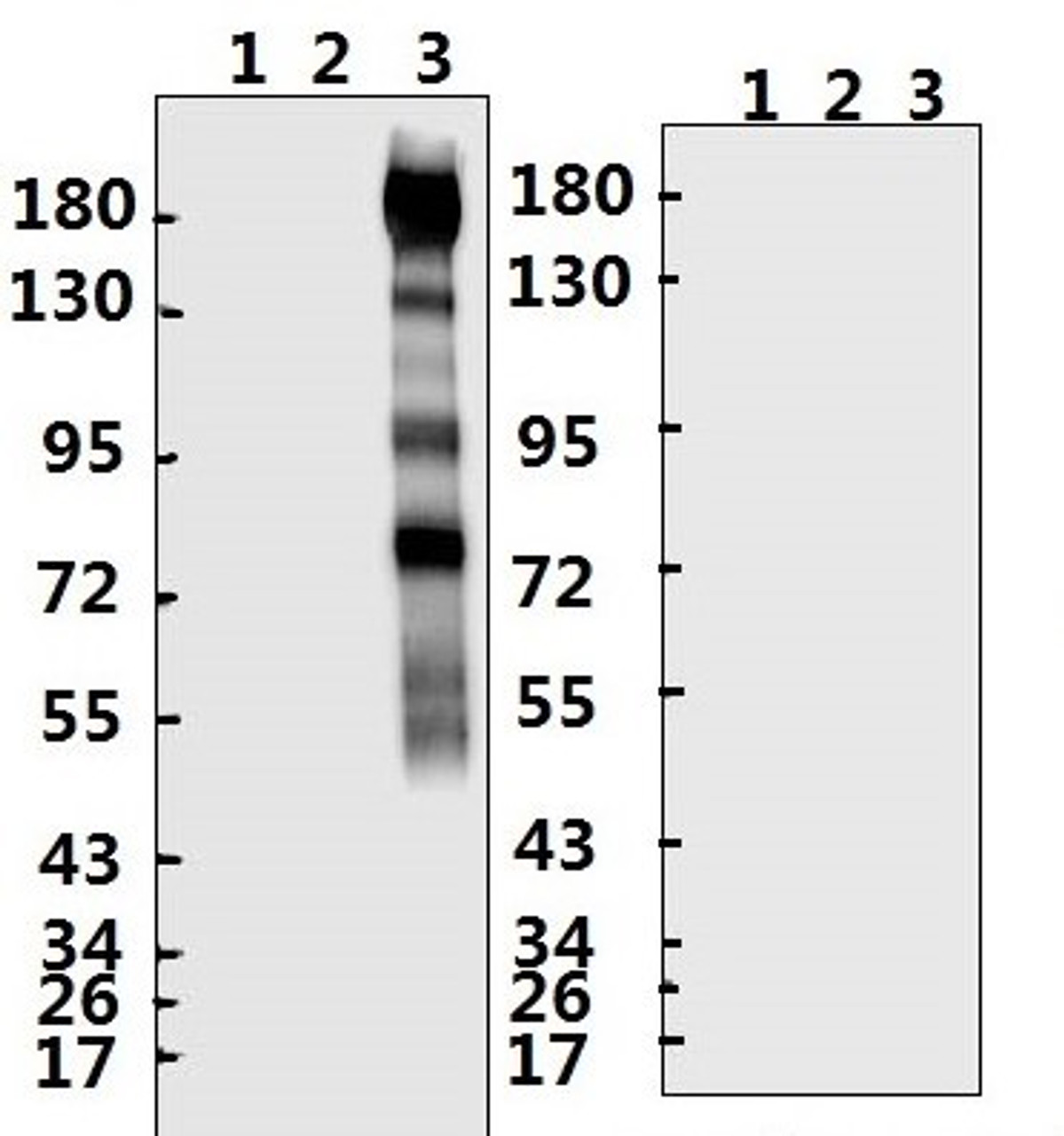 <strong>Figure 1 Western Blot Validation with Recombinant Protein</strong><br>Loading: 1ug of recombinant protein per lane. Lane 1: 10-007, Lane 2: 10-008 and Lane 3: 10-011. Antibodies: SARS-CoV-2 (COVID-19) Spike S2, 10-527, 1:500. Secondary: Goat anti-rabbit IgG HRP conjugate at 1:20000 dilution.