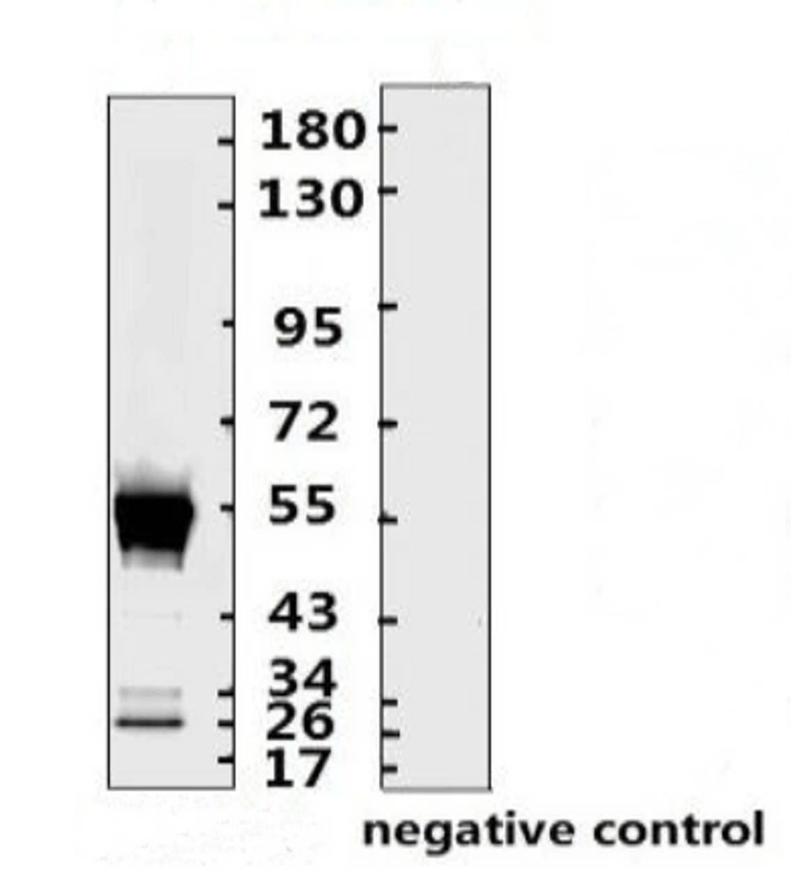 <strong>Figure 1 Western Blot Validation with Recombinant Protein</strong><br>Loading: 1ug of SARS-CoV-2 (COVID-19) nucleocapsid recombinant protein, 10-007, per lane. Antibodies: SARS-CoV-2 (COVID-19) Nucleocapsid Monoclonal Antibody, 10-549, 1:2000. Secondary: Goat anti-human IgG HRP conjugate at 1:5000 dilution.