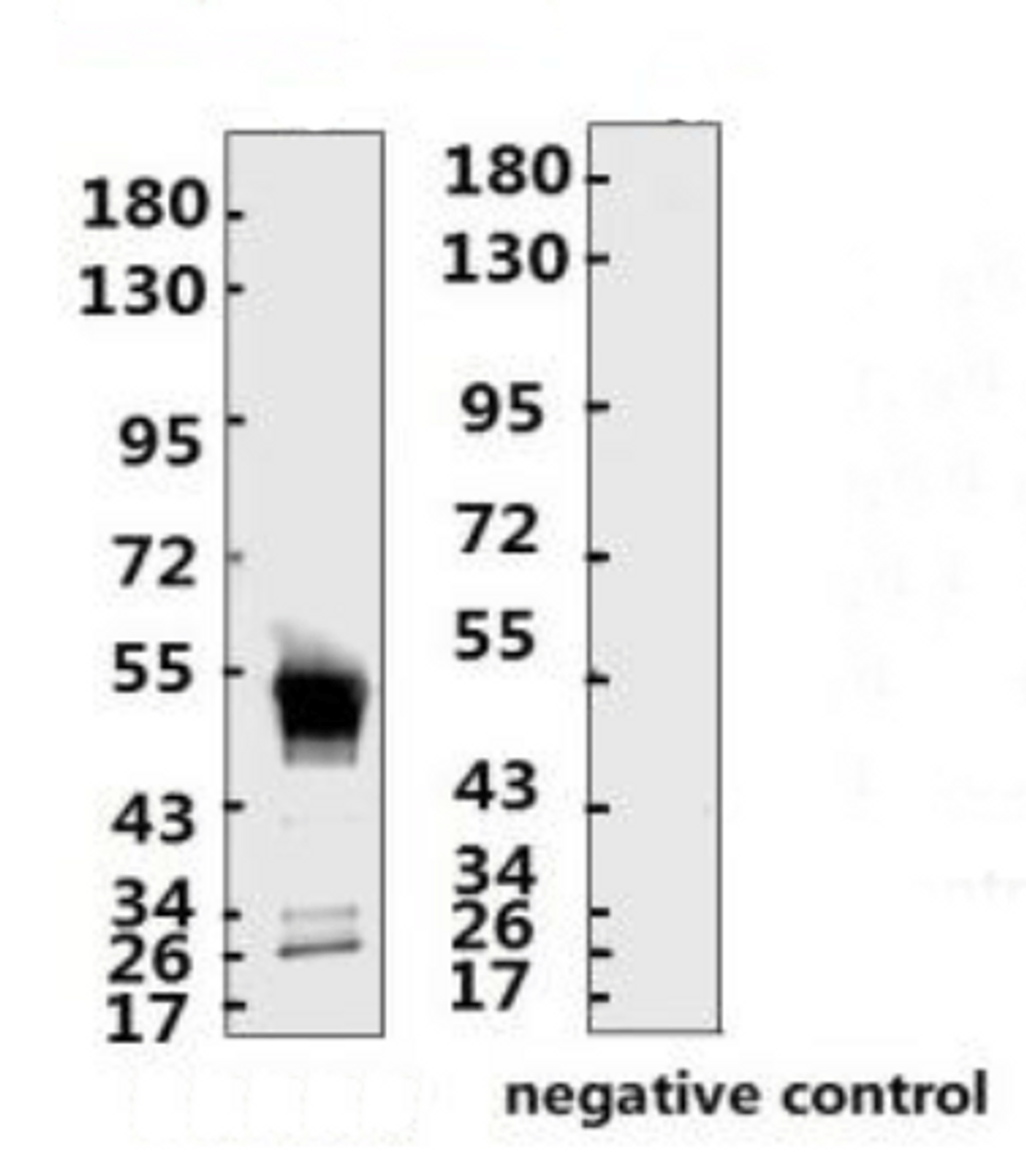 <strong>Figure 1 Western Blot Validation with Recombinant Protein</strong><br>Loading: 1ug of SARS-CoV-2 (COVID-19) nucleocapsid recombinant protein, 10-007, per lane. Antibodies: SARS-CoV-2 (COVID-19) Nucleocapsid Monoclonal Antibody, 10-550, 1:2000. Secondary: Goat anti-human IgG HRP conjugate at 1:5000 dilution.