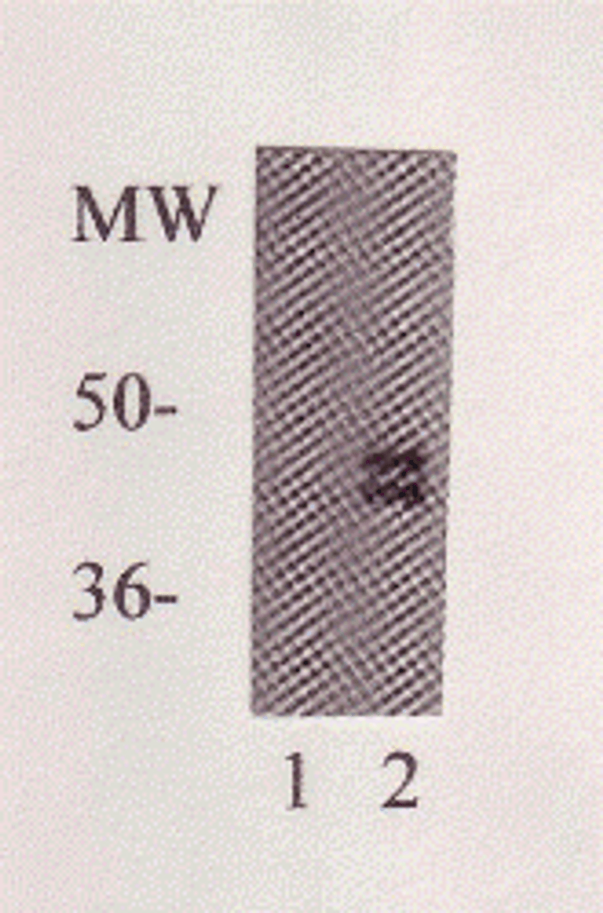 PPARgamma Antibody | XG-6173