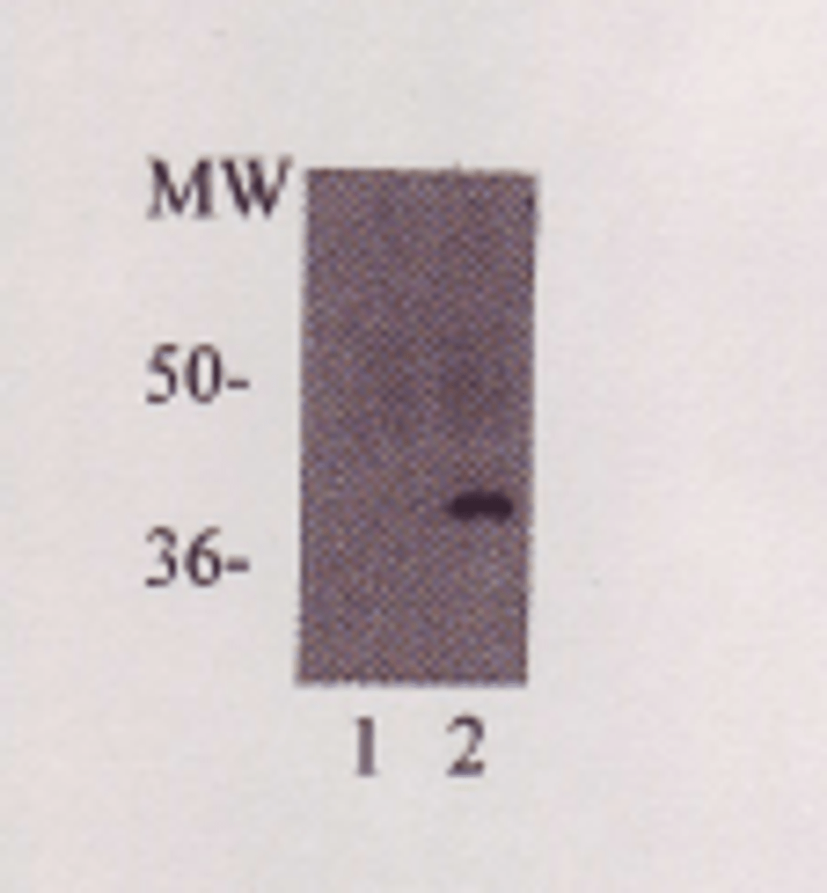 C-Reactive Protein Antibody | XG-6175