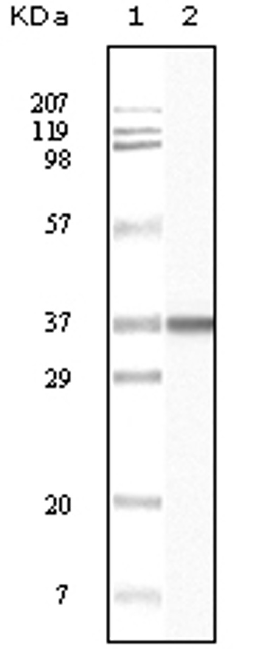 Western blot analysis using BLK monoclonal antibody against truncated BLK recombinant protein.