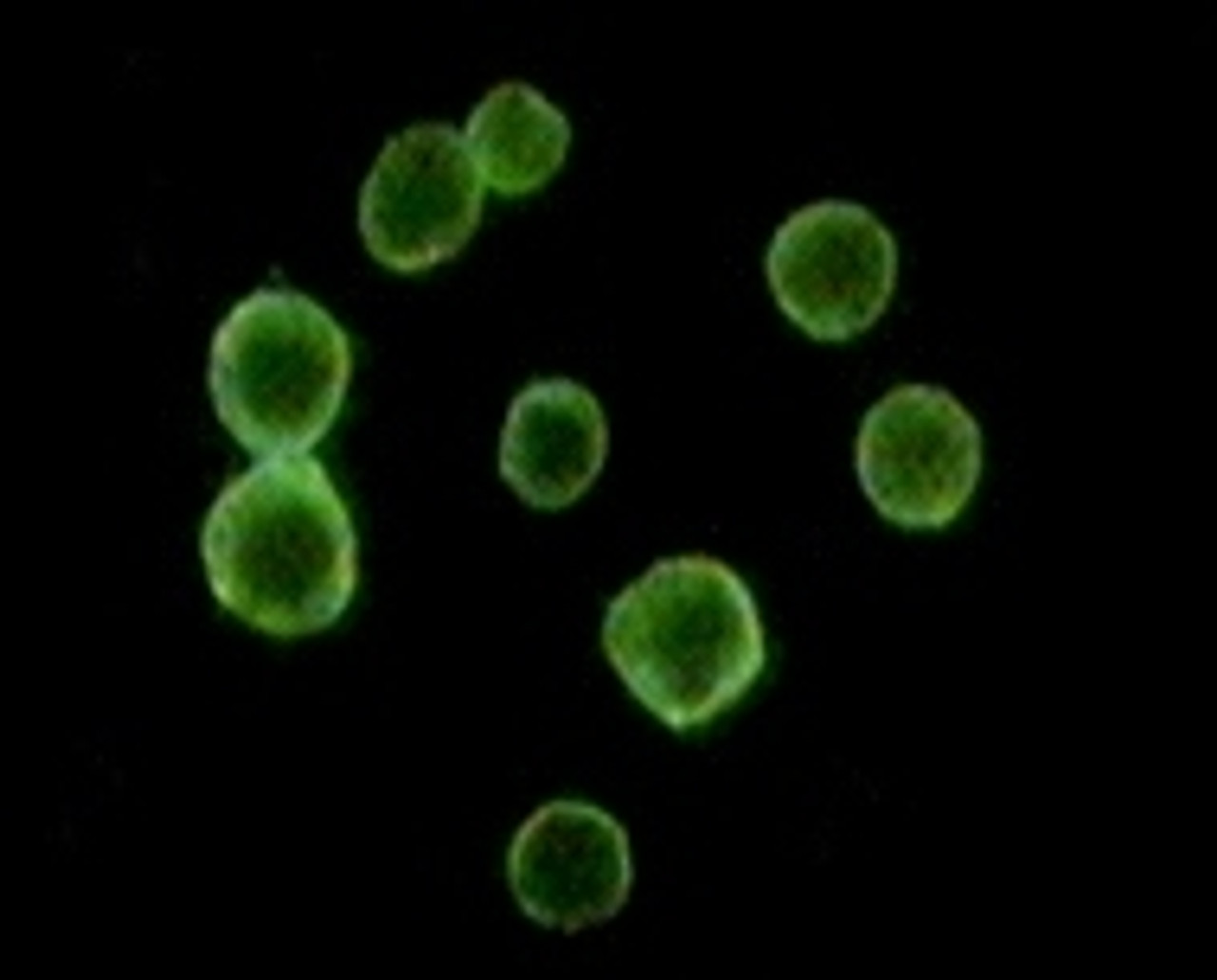 Immunofluorescense analysis of peripheral blood cells using CD34 monoclonal antibody with FITC - IgG.