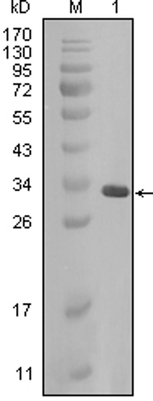 Western blot analysis using CRYAB monoclonal antibody against full - length CRYAB - Trx recombinant protein