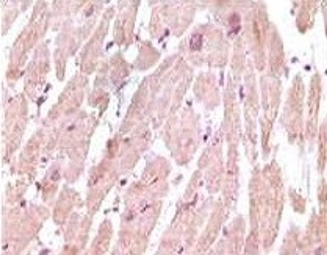 Immunohistochemical analysis of paraffin - embedded human normal heart tissue showing cytoplasmic localization using cTnI antibody with DAB staining