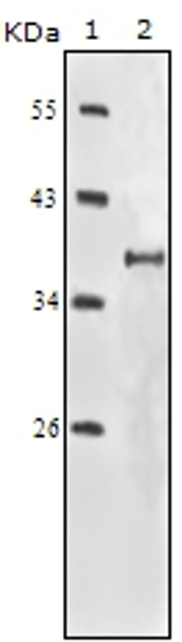 Western blot analysis using IGF1R monoclonal antibody against truncated IGF1R - His recombinant protein