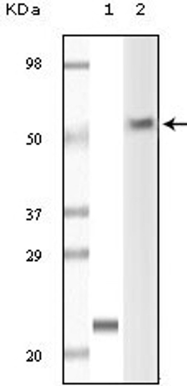 Western blot analysis using LCK monoclonal antibody against truncated LCK recombinant protein and Jurkat cell lysate.