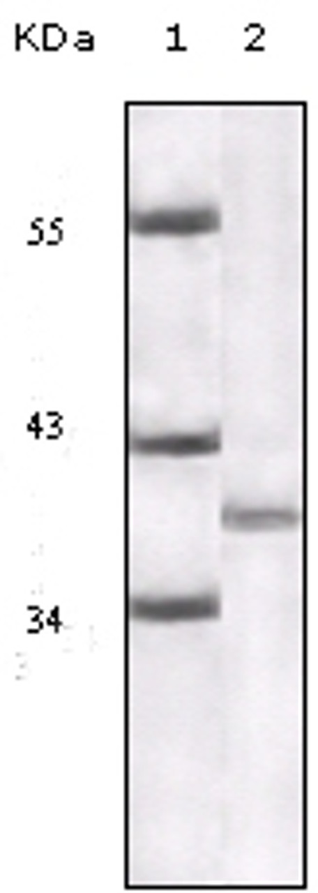 Western blot analysis using P16 monoclonal antibody against truncated P16 recombinant protein.