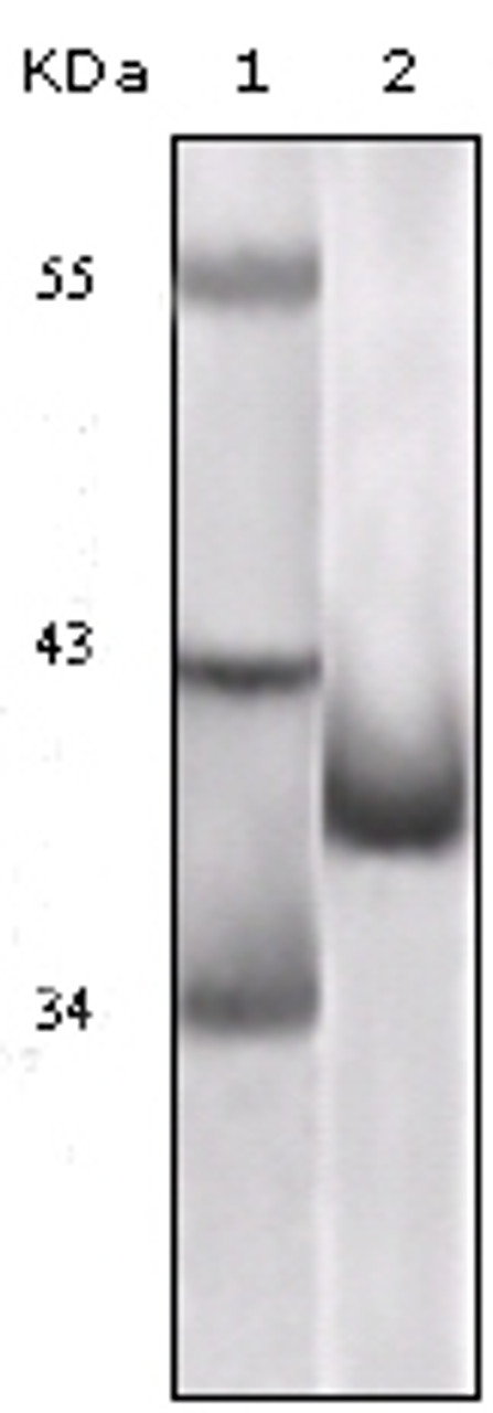 Western blot analysis using P16 monoclonal antibody against truncated P16 recombinant protein.