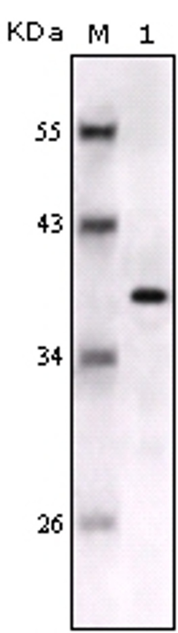Western blot analysis using anti - S100B monoclonal antiobdy against full - length S100B recombinant protein.