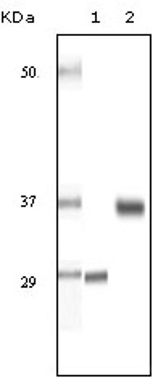 Western blot analysis using SRA monoclonal antibody against truncated SRA recombinant protein and human ovary cancer tissue lysate .