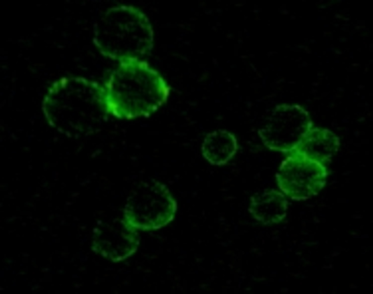 Immunofluorescense staining of methanol - fixed MCF - 7 (top) and HepG - 2 (bottom) cells showing membrane / cyoplasma localization.