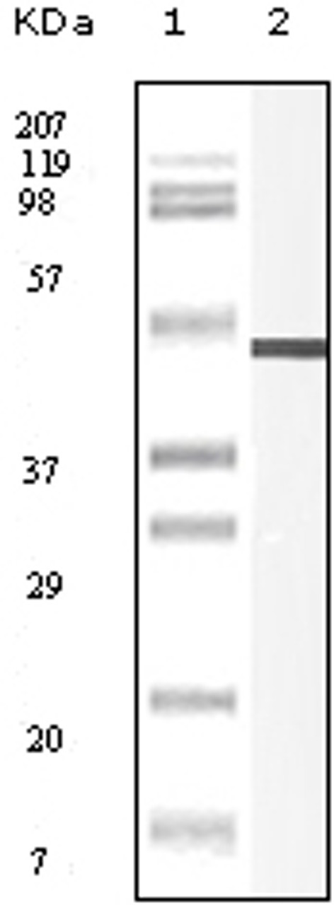 Western blot analysis using Vimentin monoclonal antibody against truncated Vimentin recombinant protein