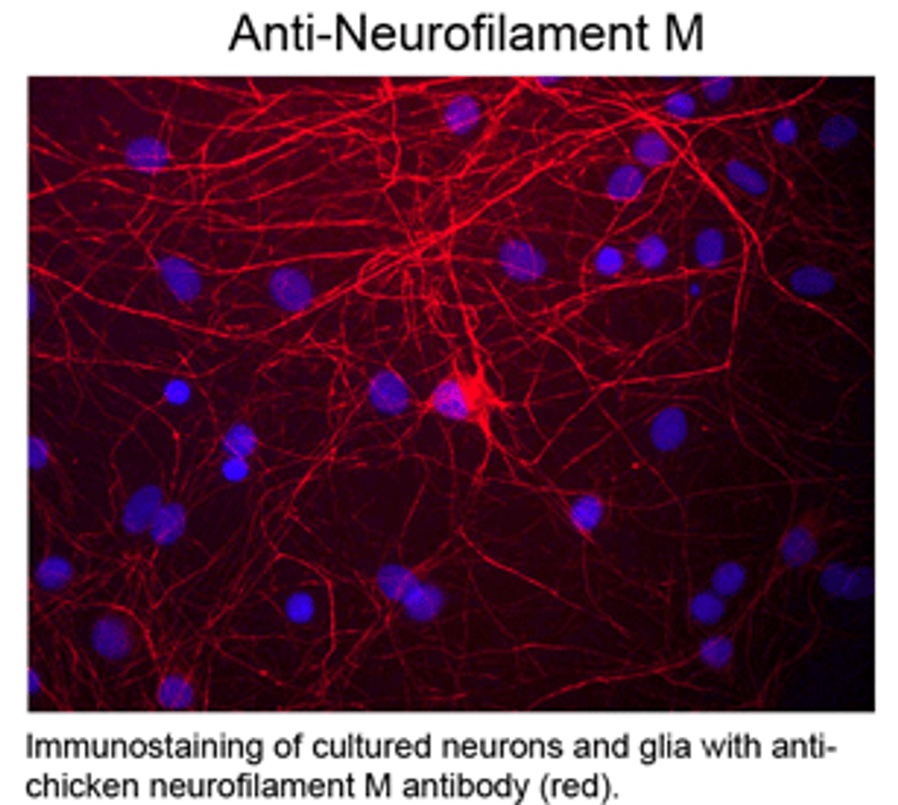 Immunostaining of cultured neurons and glia with anti-chicken neurofilament M antibody (red) .