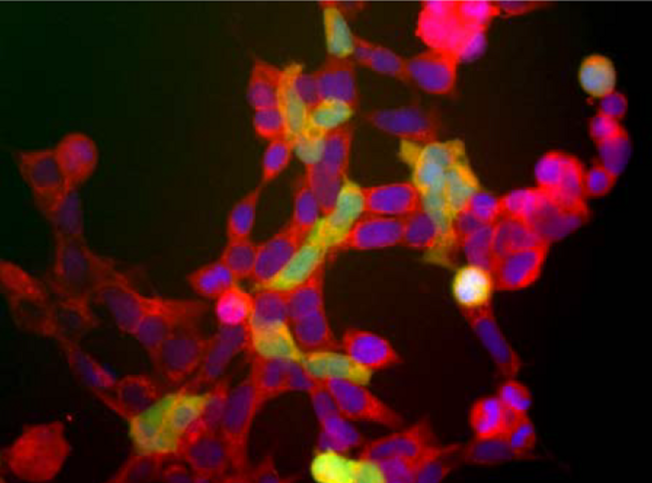 Immunostaining of HEK293 cells with anti-NSE (red) and anti-mouse UCHL1 (green) (Cat. No. 50-263) antibodies.