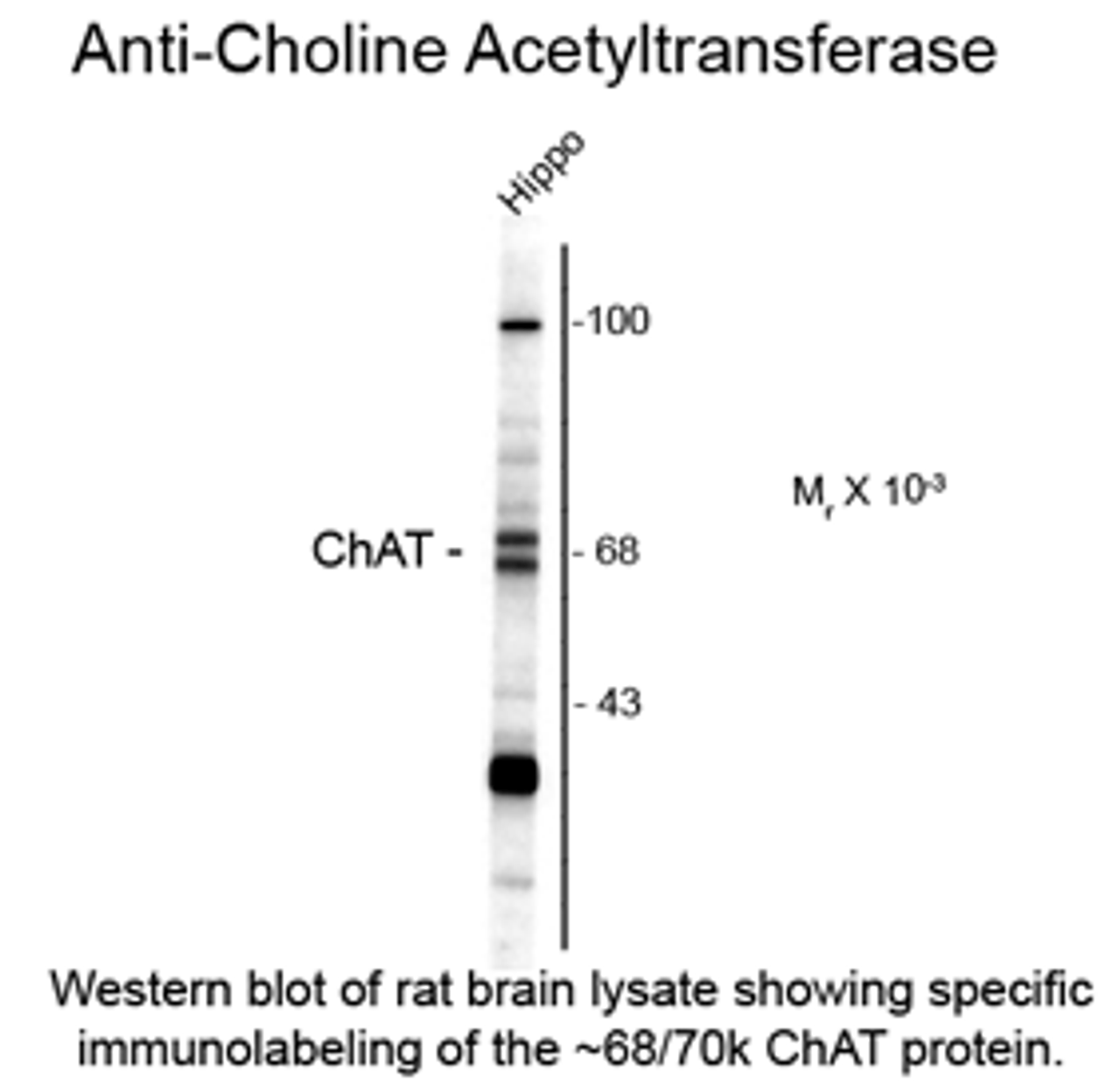 Western blot of rat brain lysate showing specific immunolabeling of the ~68/70k ChAT protein.