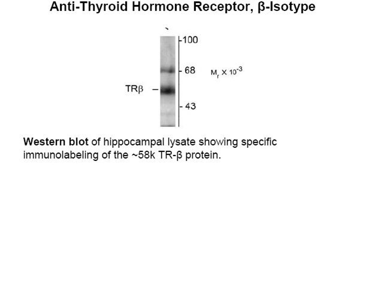 Western blot of hippocampal lysate showing specific immunolabeling of the ~58k TR-beta protein.