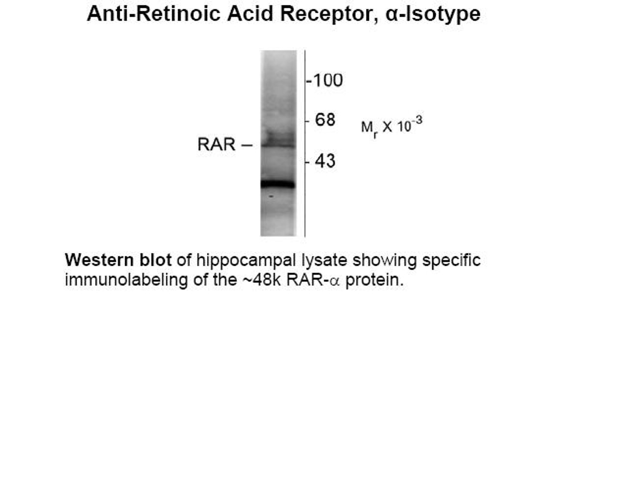 Western blot of hippocampal lysate showing specific immunolabeling of the ~48k RAR-alpha protein.