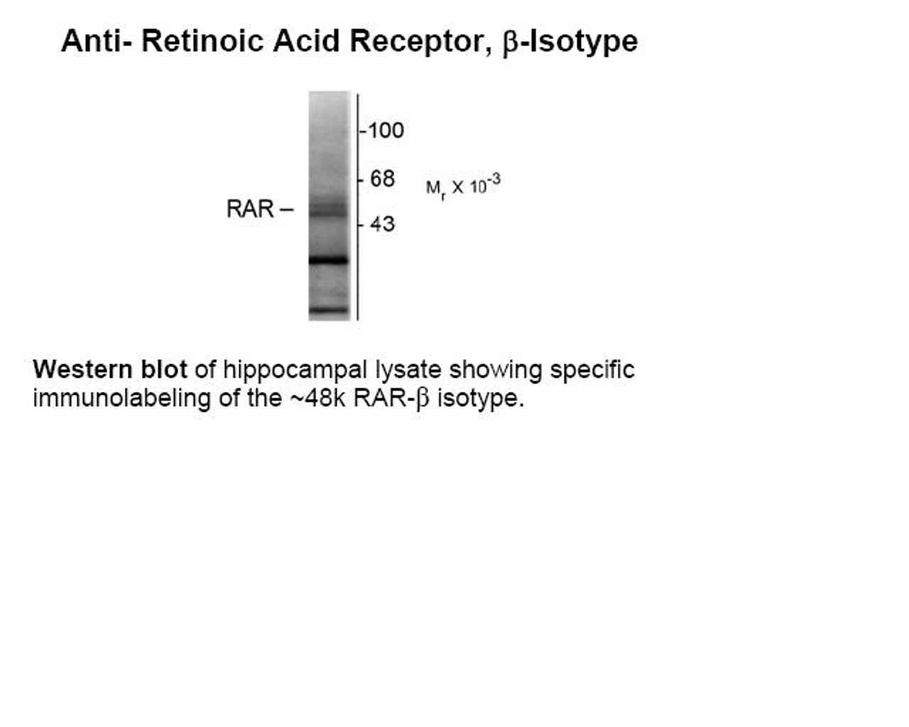 Western blot of hippocampal lysate showing specific immunolabeling of the ~48k RAR-beta isotype.