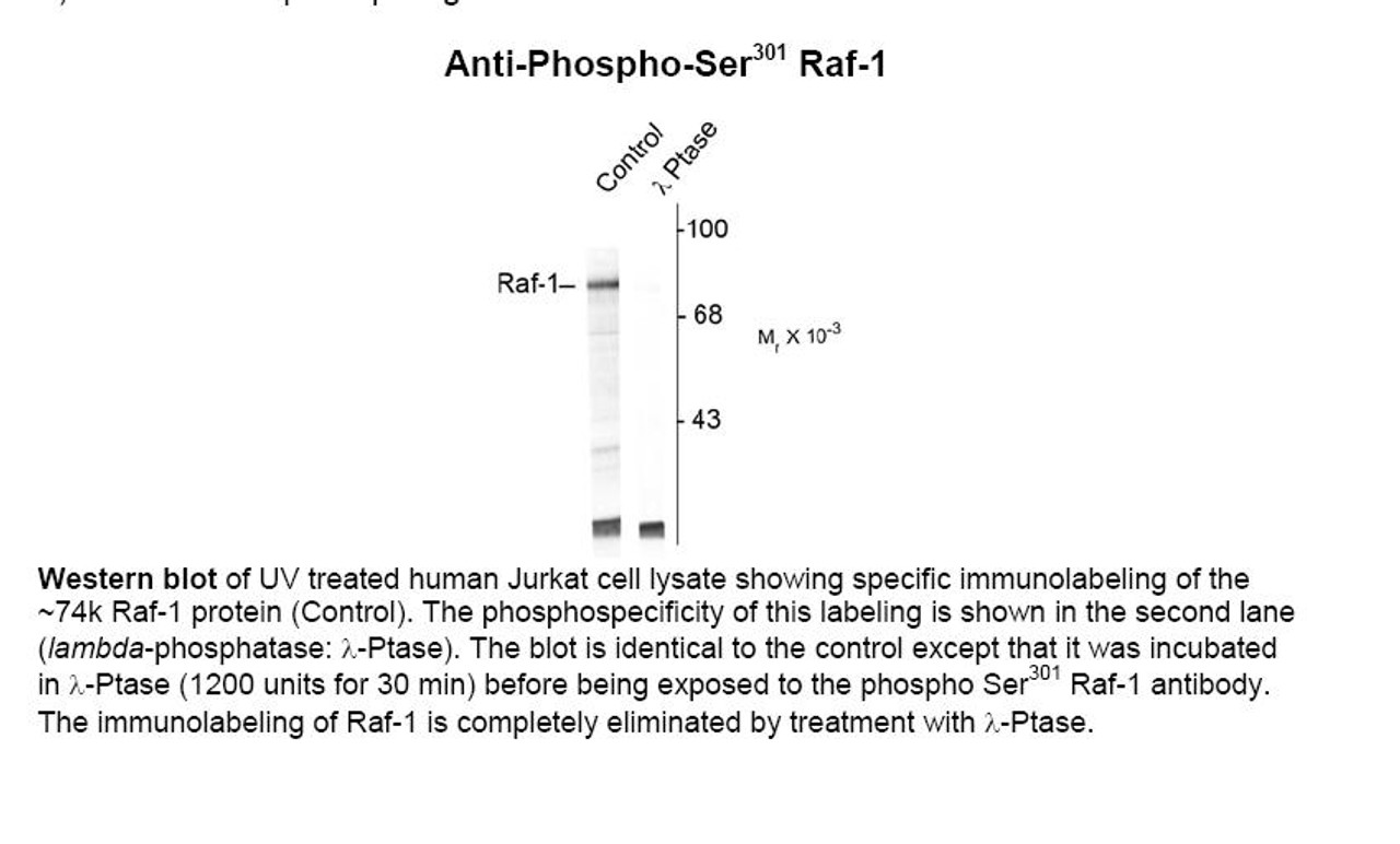 Western blot of UV treated human Jurkat cell lysate showing specific immunolabeling of the ~74k Raf-1 protein (Control) . The phosphospecificity of this labeling is shown in the second lane (lambda-phosphatase: lamda-Ptase) . The blot is identical to the control except that it was incubated in lamda-Ptase (1200 units for 30 min) before being exposed to the phospho Ser301 Raf-1 antibody. The immunolabeling of Raf-1 is completely eliminated by treatment with lamda-Ptase.