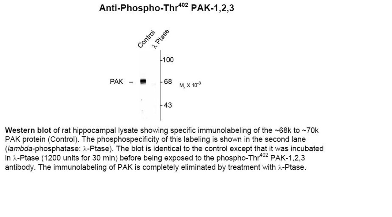 Western blot of rat hippocampal lysate showing specific immunolabeling of the ~68k to ~70k PAK protein (Control) . The phosphospecificity of this labeling is shown in the second lane (lambda-phosphatase: lamda-Ptase) . The blot is identical to the control except that it was incubated in lamda-Ptase (1200 units for 30 min) before being exposed to the phospho-Thr402 PAK-1, 2, 3 antibody. The immunolabeling of PAK is completely eliminated by treatment with lamda-Ptase.