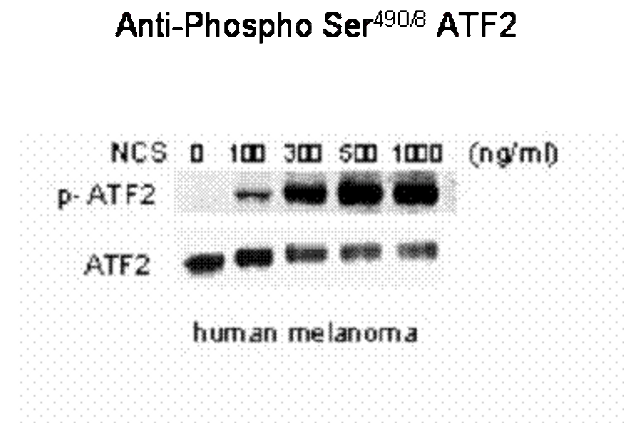 Western blot of human melanoma cells incubated with varying doses of the radiometric drug NCS showing phospho-specific immunolabeling of the ATF2 protein phosphorylated at Ser 490, 498.