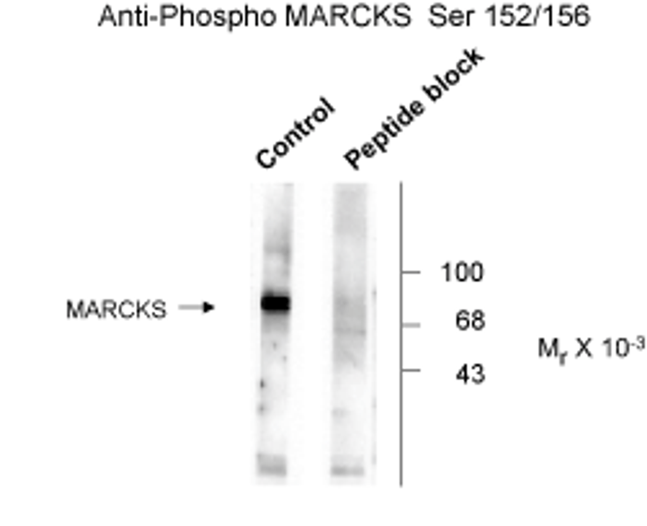 Western blot of rat brain lysate showing phospho-specific immunolabeling of the ~87k MARCKS protein.