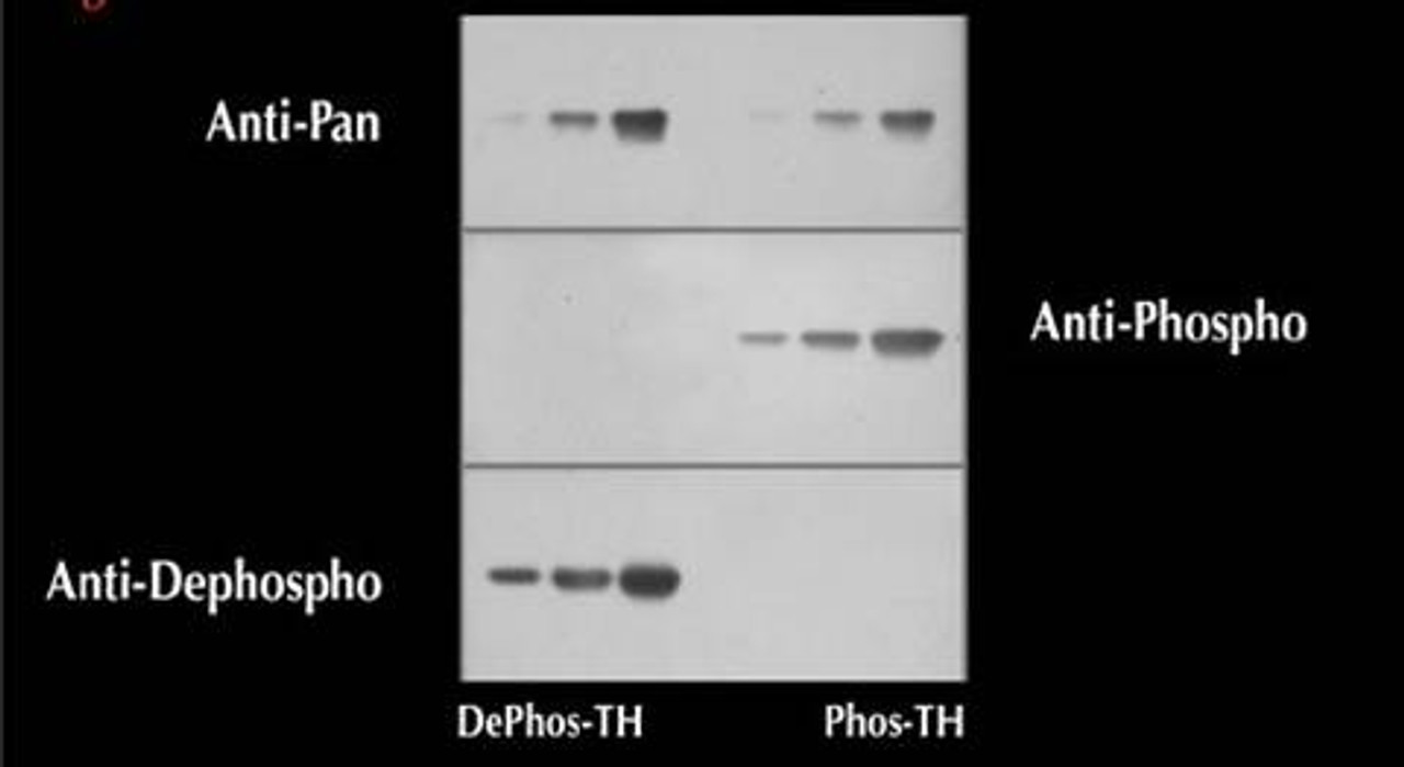 Western Blots of phospho- and dephospho-proteins to demonstrate the selectivity of the Phospho-Specific Antibody. The Pan-Specific Antibody recognized both the dephospho-Tyrosine Hydroxylase (dephospho-TH) and the phospho-Tyrosine Hydroxylase (phospho-TH) . Most importantly, the Phospho-Specific Antibody recognized only phospho-TH whereas the Dephospho-Specific Antibody reacted selectively with dephospho-TH.<br><br><b>Below:</b>:Immunohistochemical staining of retina with the Pan-Tyrosine Hydroxylase (Pan-TH) and Phospho-Specific Tyrosine Hydroxylase (Phospho-TH) Antibodies. The Pan-TH Antibody shows extensive labeling in this photomicrograph of the retina. In contrast, the Phospho-TH Antibody selectively labels only the two amacrine cells in this light-stimulated retina example