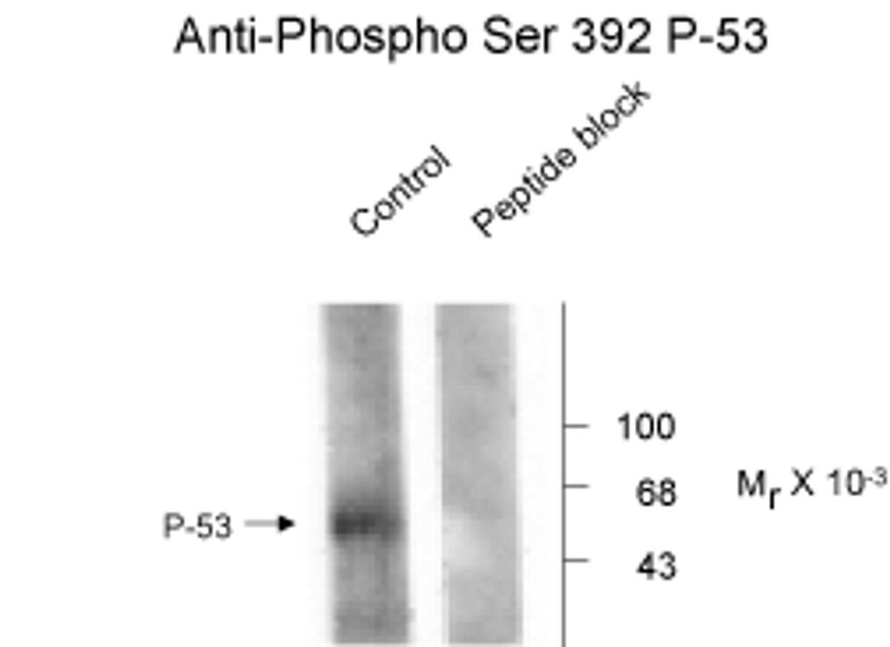 NMDA NR1, Splice Variant C1 Antibody