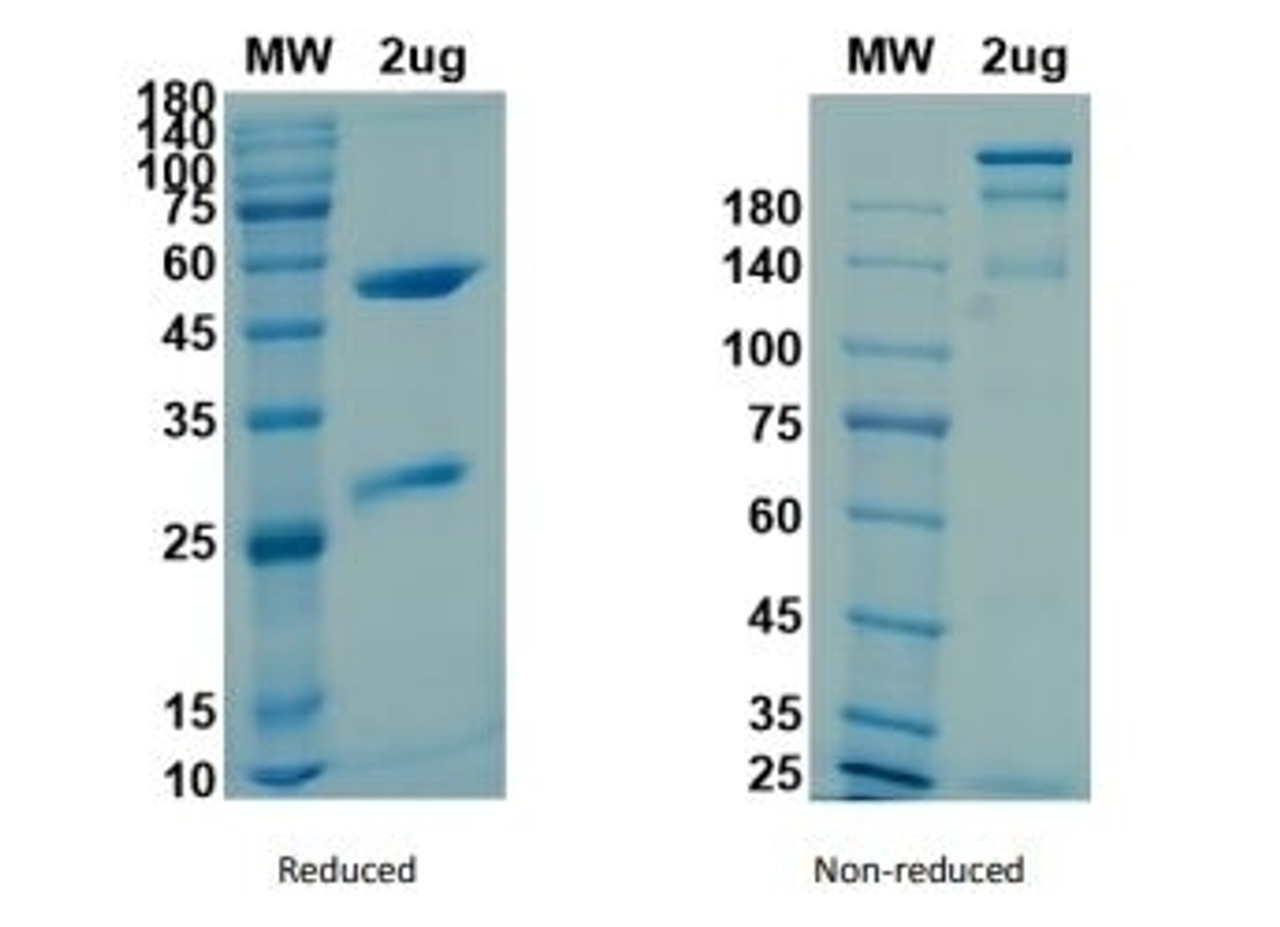 Coomassie blue staining non-reduced and reduced SDS-PAGE analysis