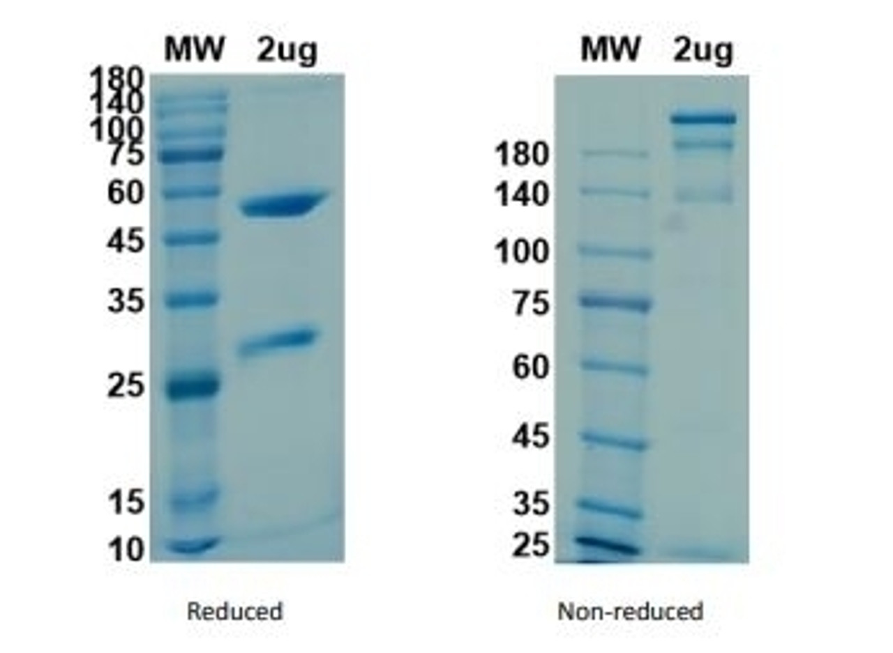 Coomassie blue staining non-reduced and reduced SDS-PAGE analysis