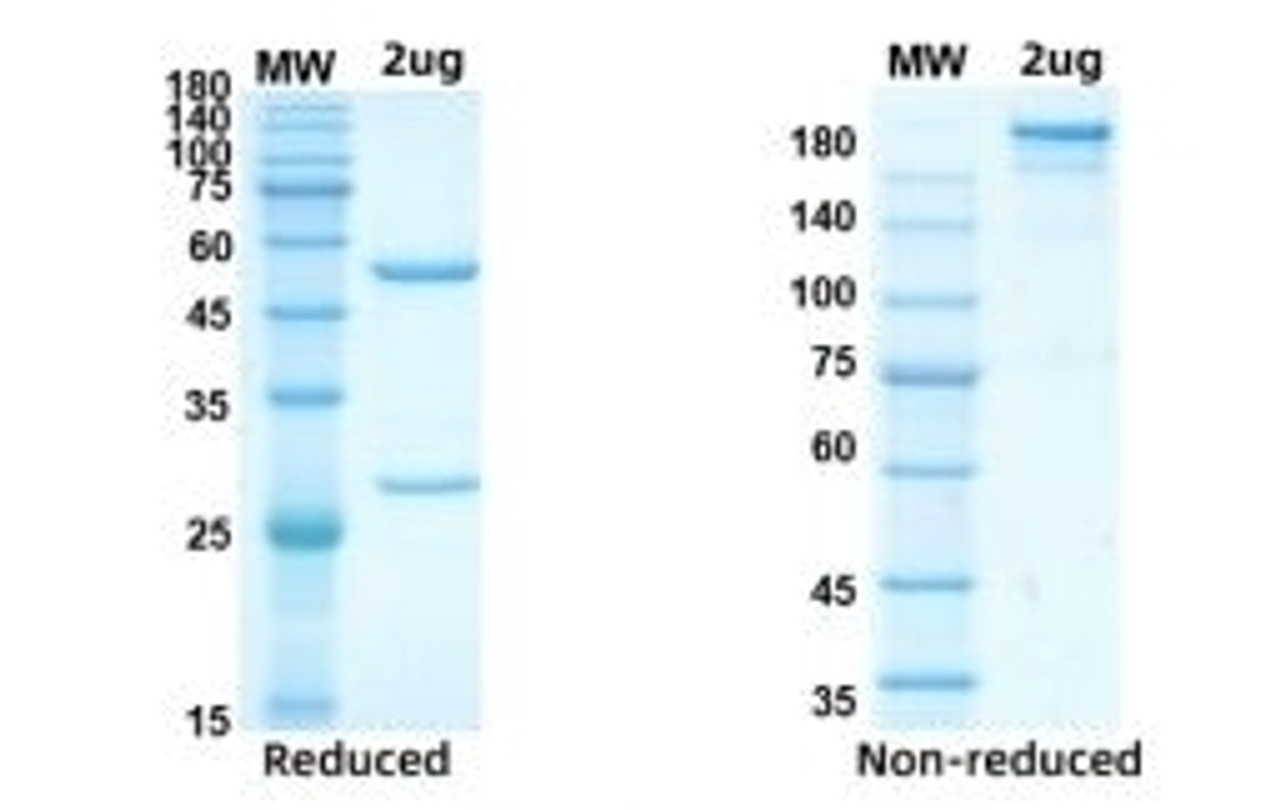 Coomassie blue staining non-reduced and reduced SDS-PAGE analysis