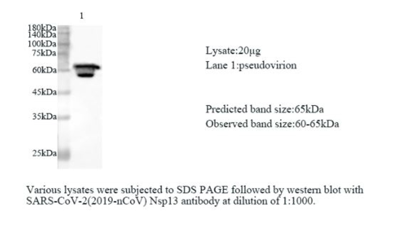 Various lysates were subjected to SDS-PAGE followed by western blot with SARS-CoV-2 (2019-nCoV) Nsp13 antibody at dilution of 1:1000