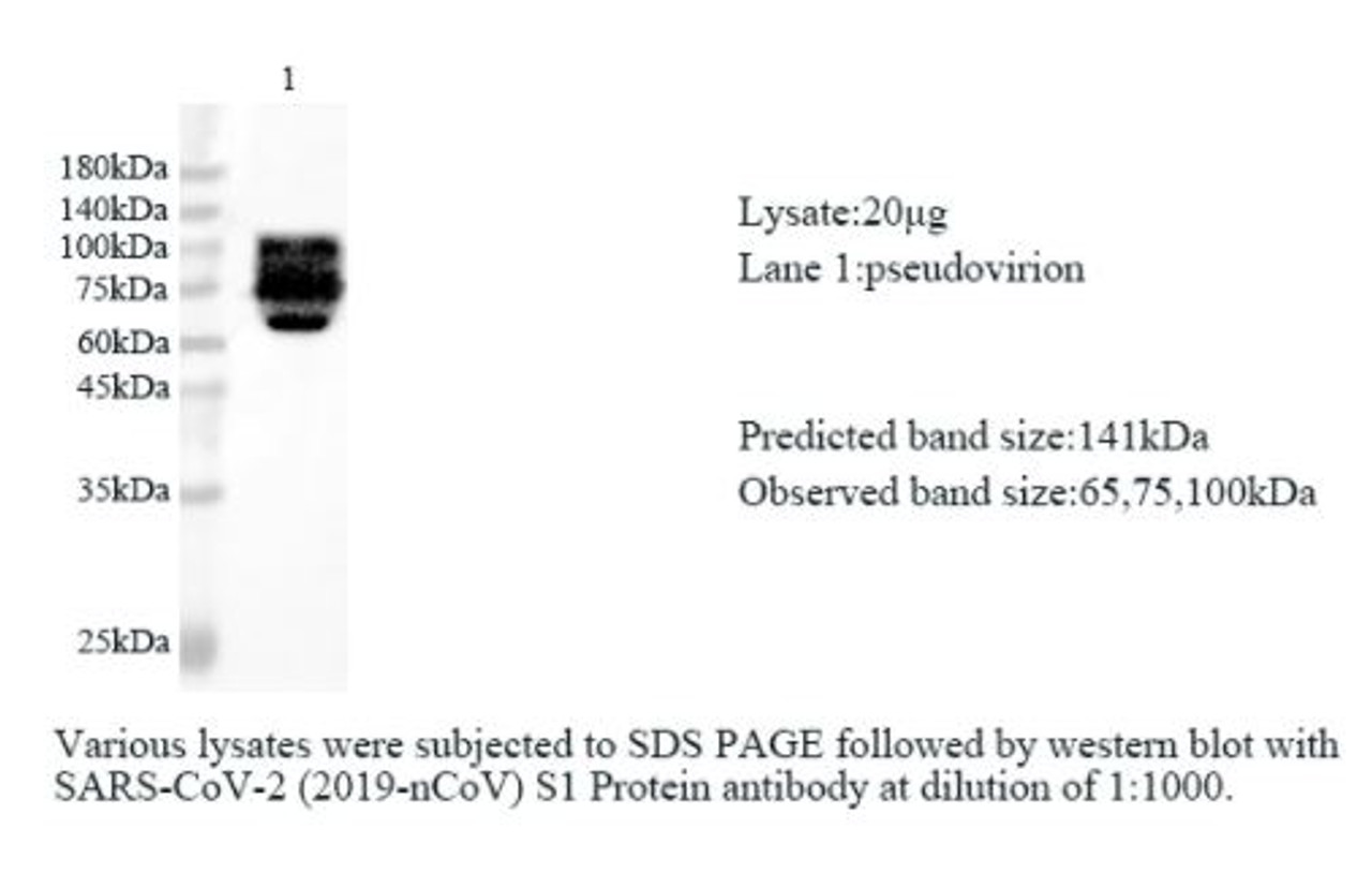 Various lysates were subjected to SDS-PAGE followed by western blot with SARS-CoV-2 (2019-nCoV) S1 Protein antibody at dilution of 1:1000