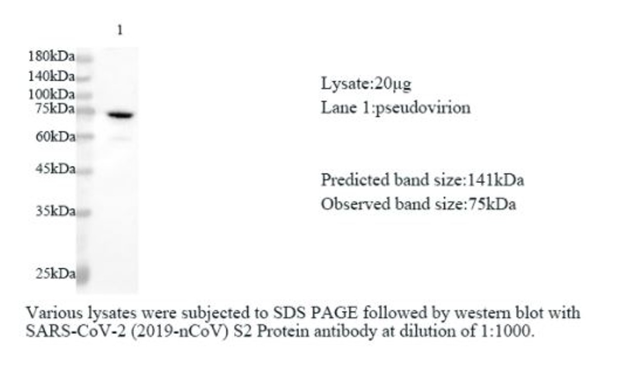 Various lysates were subjected to SDS-PAGE followed by western blot with SARS-CoV-2 (2019-nCoV) S2 Protein antibody at dilution of 1:1000