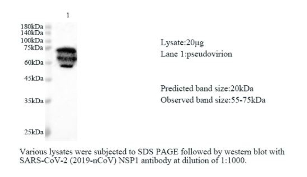 Various lysates were subjected to SDS-PAGE followed by western blot with SARS-CoV-2 (2019-nCoV) NSP1 antibody at dilution of 1:1000