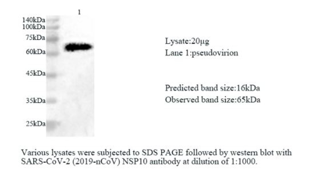 Various lysates were subjected to SDS-PAGE followed by western blot with SARS-CoV-2 (2019-nCoV) NSP10 antibody at dilution of 1:1000