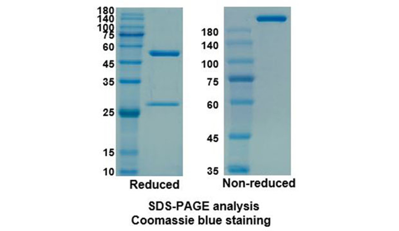 Sarilumab (IL6R/CD126) Antibody, Monoclonal | 10-475