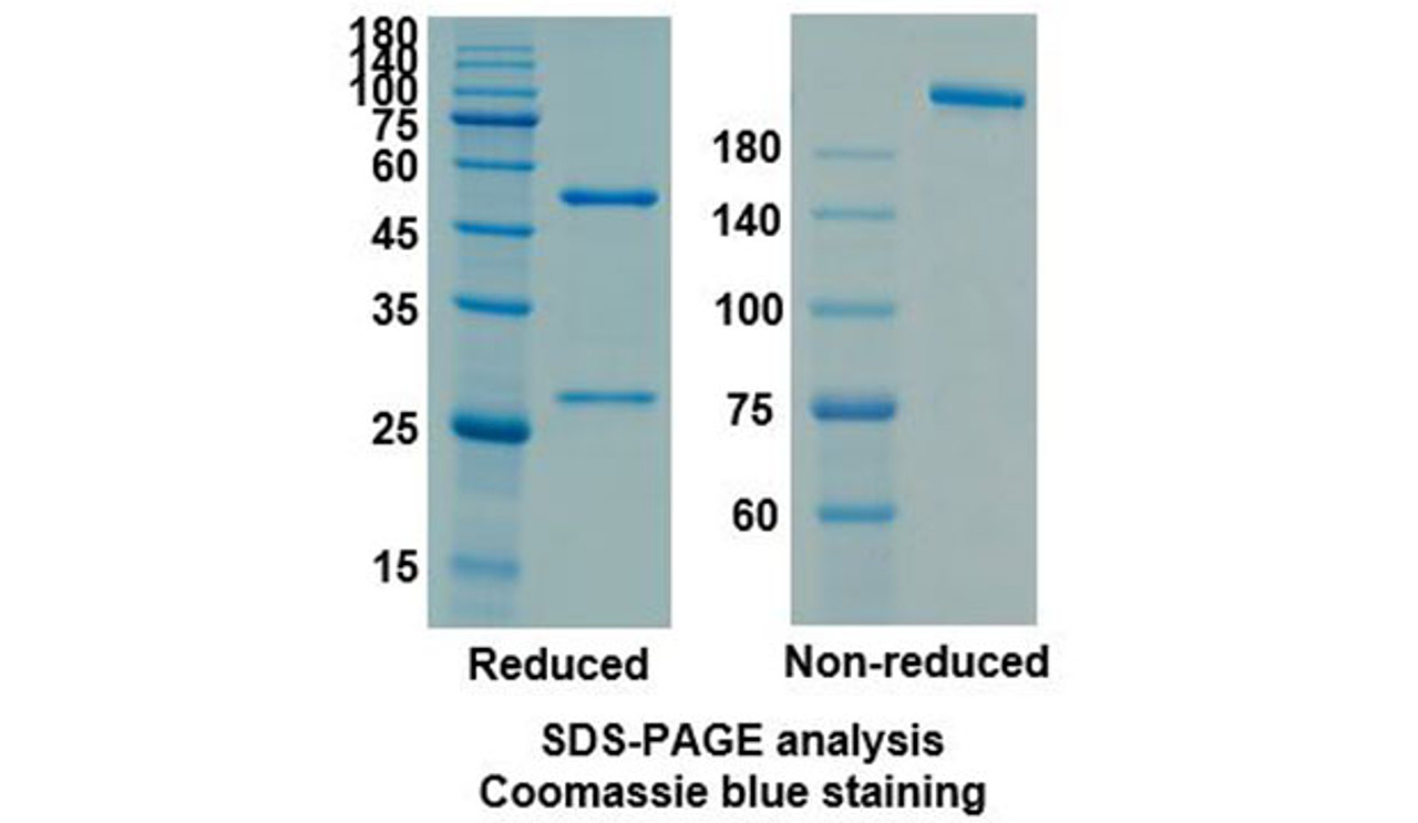 Siltuximab (IL6) Antibody, Monoclonal | 10-313