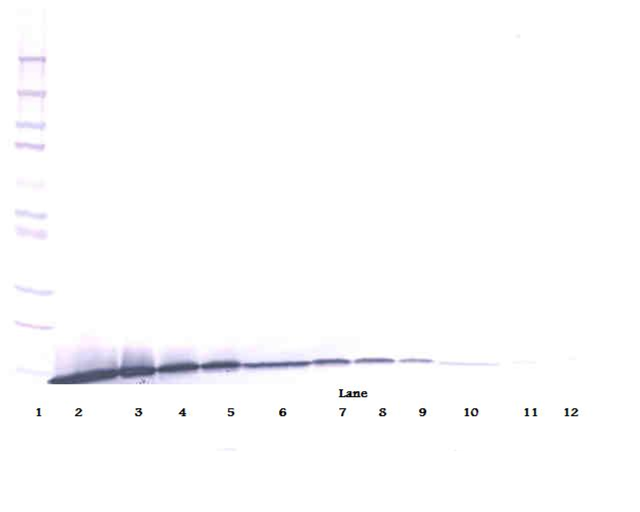 To detect hArtemin by Western Blot analysis this antibody can be used at a concentration of 0.1 - 0.2 ug/ml. Used in conjunction with compatible secondary reagents the detection limit for recombinant hArtemin is 1.5 - 3.0 ng/lane, under either reducing or non-reducing conditions.