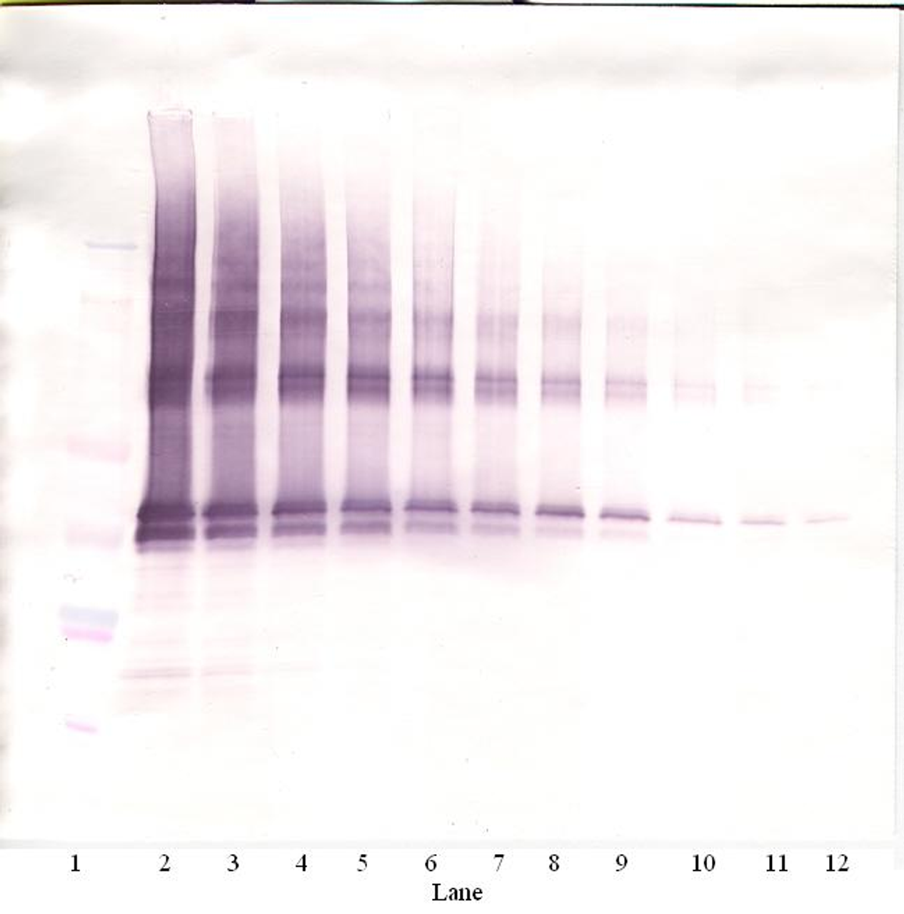 To detect hNanog by Western Blot analysis this antibody can be used at a concentration of 0.1 - 0.2 ug/ml. Used in conjunction with compatible secondary reagents the detection limit for recombinant hNanog is 1.5 - 3.0 ng/lane, under either reducing or non-reducing conditions.