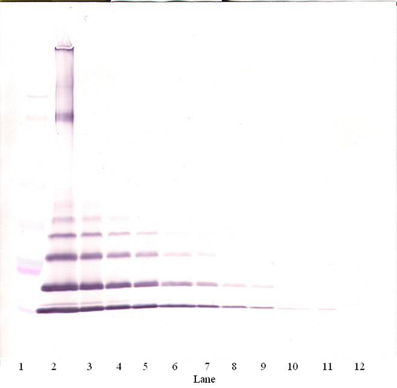 To detect mMCP-2 by Western Blot analysis this antibody can be used at a concentration of 0.1 - 0.2 ug/ml. Used in conjunction with compatible secondary reagents the detection limit for recombinant mMCP-2 is 1.5 - 3.0 ng/lane, under either reducing or non-reducing conditions.