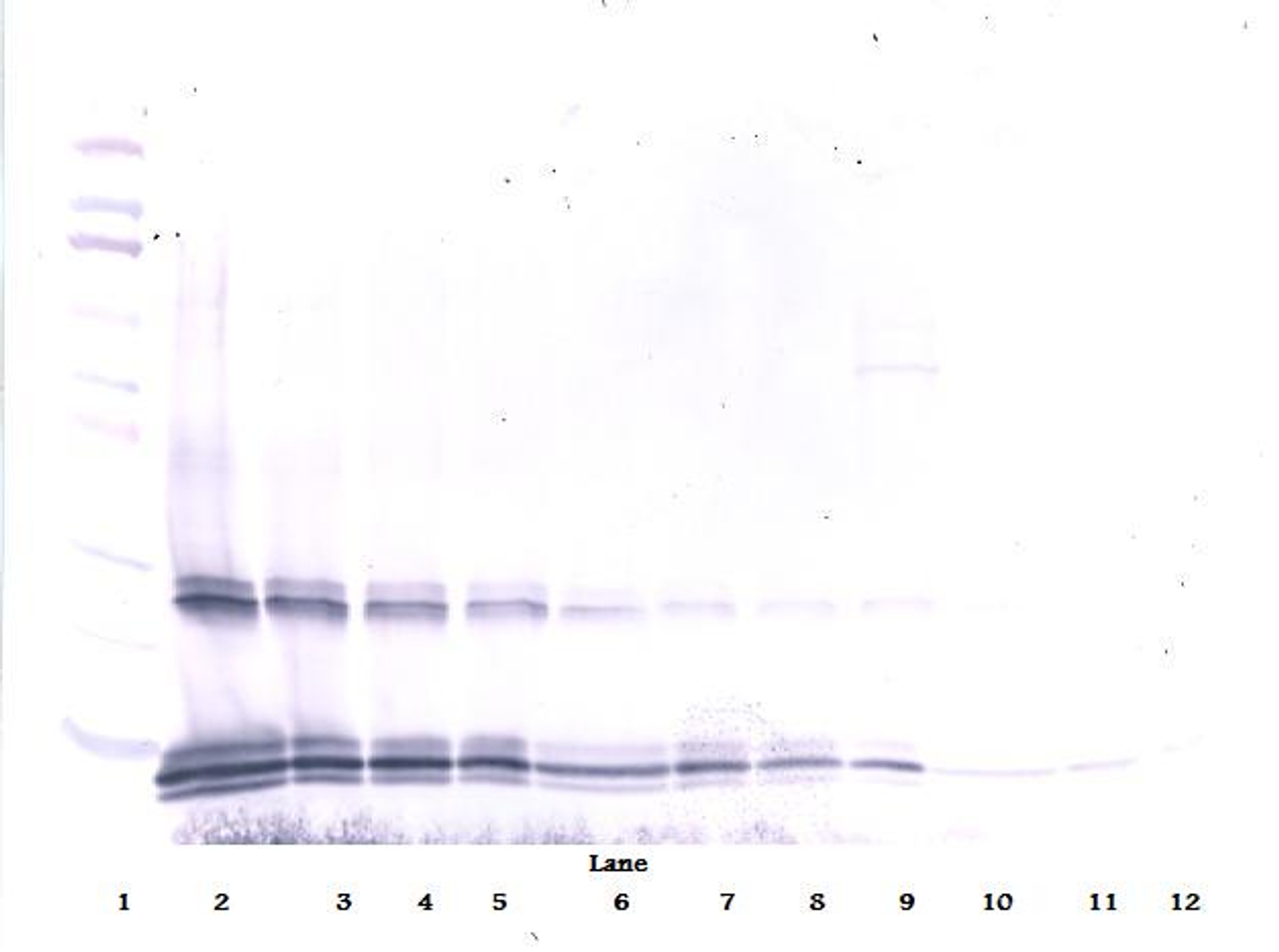 To detect mIL-15 by Western Blot analysis this antibody can be used at a concentration of 0.1 - 0.2 ug/ml. Used in conjunction with compatible secondary reagents the detection limit for recombinant mIL-15 is 1.5 - 3.0 ng/lane, under either reducing or non-reducing conditions.
