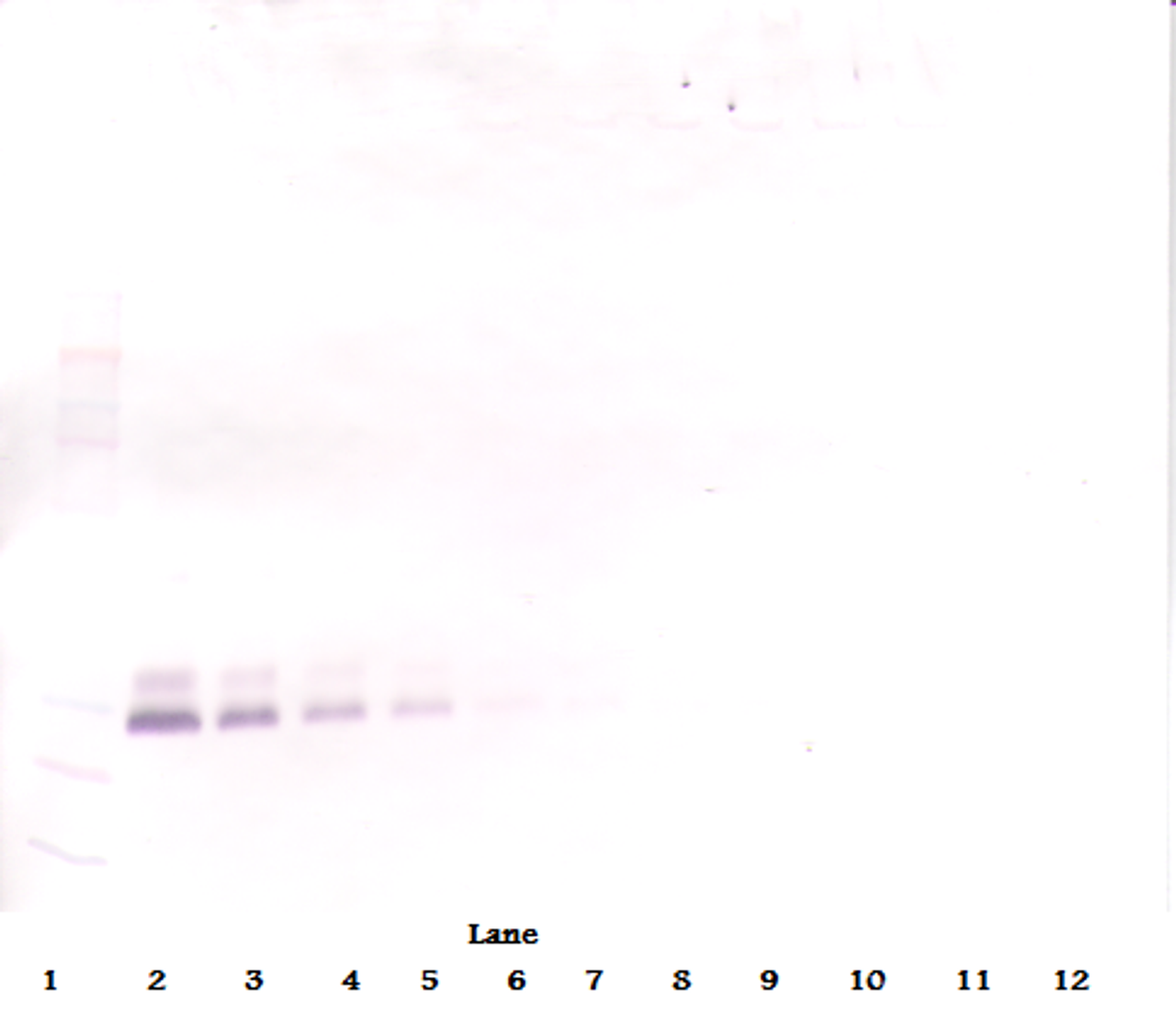 To detect hBMP-7 by Western Blot analysis this antibody can be used at a concentration of 0.1 - 0.2 ug/ml. Used in conjunction with compatible secondary reagents the detection limit for recombinant hBMP-7 is 1.5 - 3.0 ng/lane, under either reducing or non-reducing conditions.