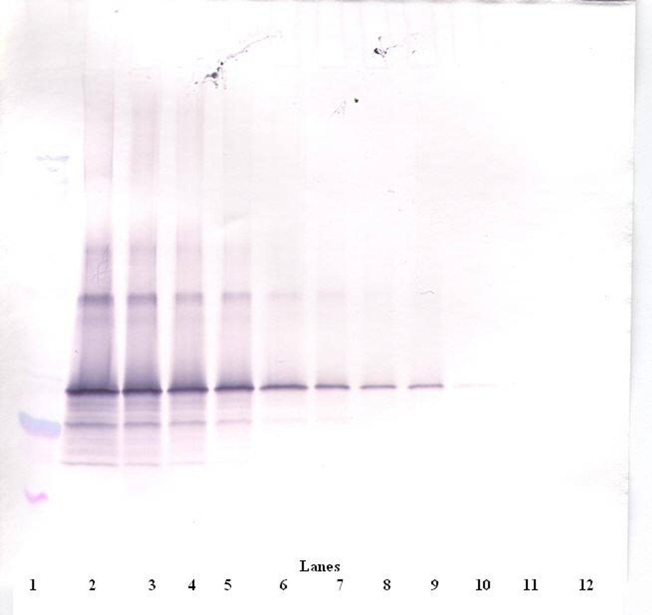 To detect Human Follistatin by Western Blot analysis this antibody can be used at a concentration of 0.1 - 0.2 ug/ml. When used in conjunction with compatible secondary reagents the detection limit for recombinant Human Follistatin is 1.5 - 3.0 ng/lane, under either reducing or non-reducing conditions.