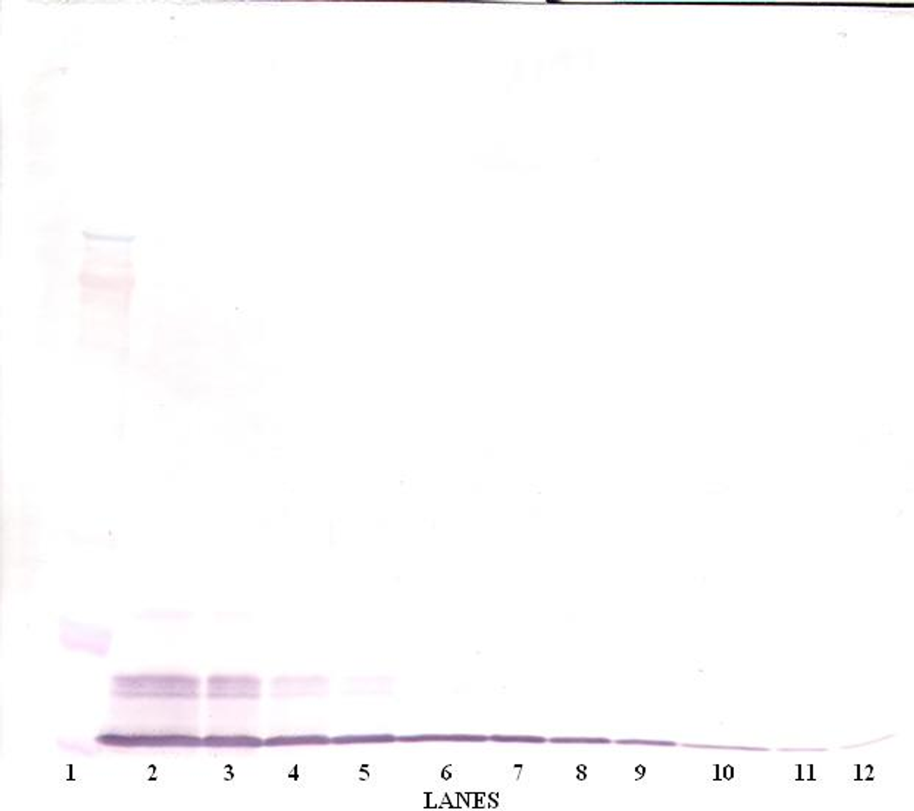 To detect Murine MIP-1-beta by Western Blot analysis this antibody can be used at a concentration of 0.1 - 0.2 ug/ml. Used in conjunction with compatible secondary reagents the detection limit for recombinant Murine MIP-1-beta is 1.5 - 3.0 ng/lane, under either reducing or non-reducing conditions.