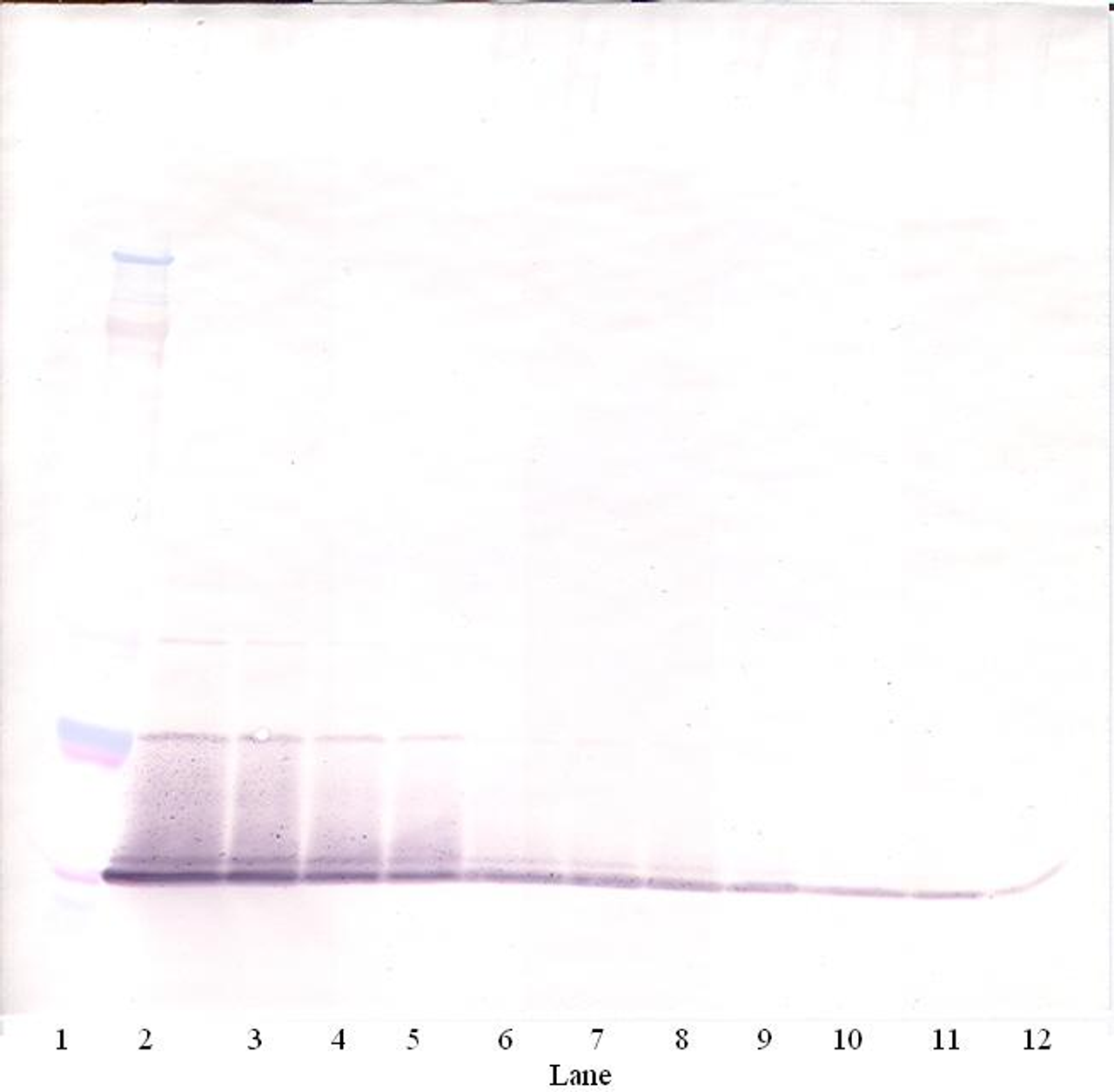 To detect Murine RELM-alpha by Western Blot analysis this antibody can be used at a concentration of 0.1 - 0.2 ug/ml. When used in conjunction with compatible secondary reagents, the detection limit for recombinant Murine RELM-alpha is 1.5 - 3.0 ng/lane, under either reducing or non-reducing conditions.