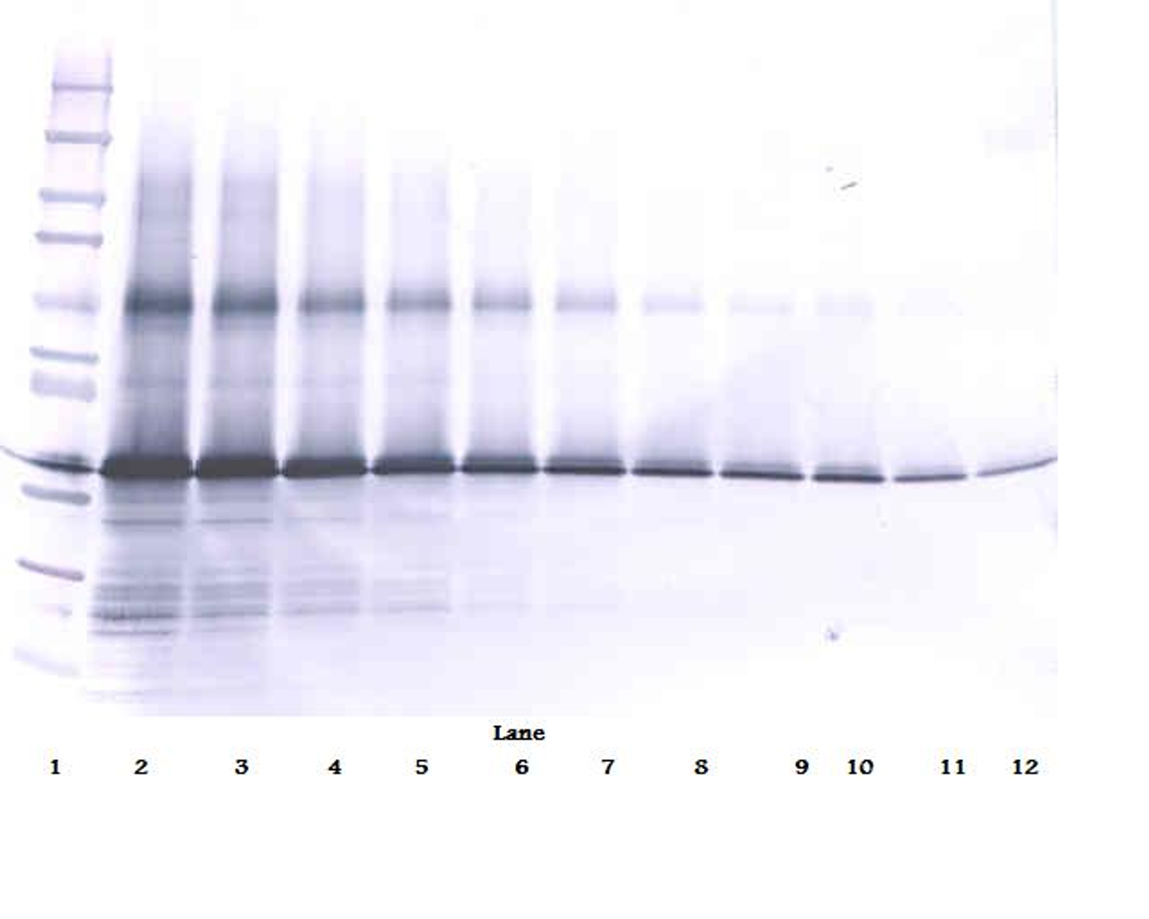 To detect hIGF-BP3 by Western Blot analysis this antibody can be used at a concentration of 0.1 - 0.2 ug/ml. Used in conjunction with compatible secondary reagents the detection limit for recombinant hIGF-BP3 is 1.5 - 3.0 ng/lane, under either reducing or non-reducing conditions.