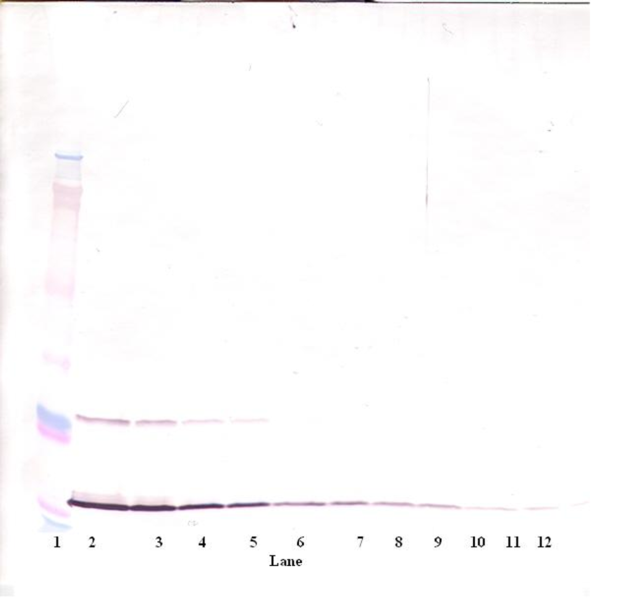 To detect hMIA by Western Blot analysis this antibody can be used at a concentration of 0.1 - 0.2 ug/ml. Used in conjunction with compatible secondary reagents the detection limit for recombinant hMIA is 1.5 - 3.0 ng/lane, under either reducing or non-reducing conditions.