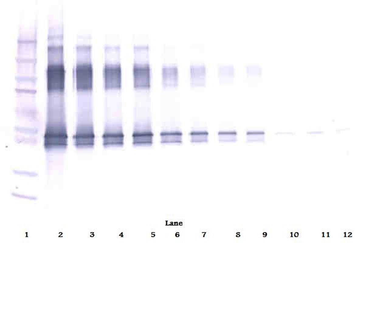 To detect hVaspin by Western Blot analysis this antibody can be used at a concentration of 0.1 - 0.2 ug/ml. Used in conjunction with compatible secondary reagents the detection limit for recombinant hVaspin is 1.5 - 3.0 ng/lane, under either reducing or non-reducing conditions.